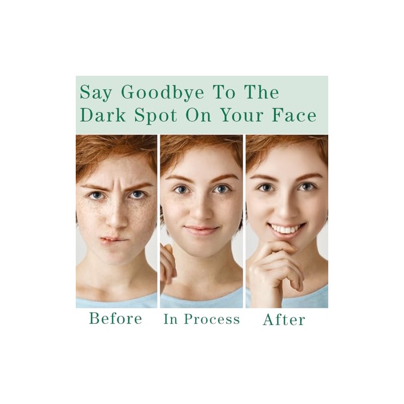 Quitamanchas para rostro y cuerpo, corrector de manchas oscuras con