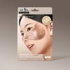 Marcique Freckle Cream Patch - Blemishes, Pigmentation, Dark Spots, Whitening,