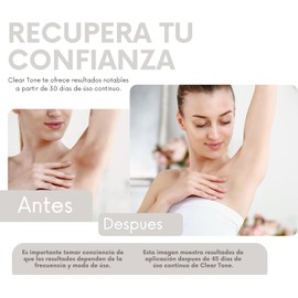 Crema Corporal Despigmentante - Clear Tone 50g.- Manchas Solares, Manchas por Edad, Desequilibrios hormonales, Hiperpigmentacion - Con Vitamina E, Retinol, Elastina, Karité, Árbol de Té, y Caléndula. - Codos, Rodillas, Tobillos, Axilas, Rostro y Manos.