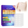 180 Pimple Patches Discretos Comodos Acné Verrugas Mezquinos