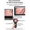 Digital Dermascope for Skin, Up to 500X Viewing, 2.8” IPS