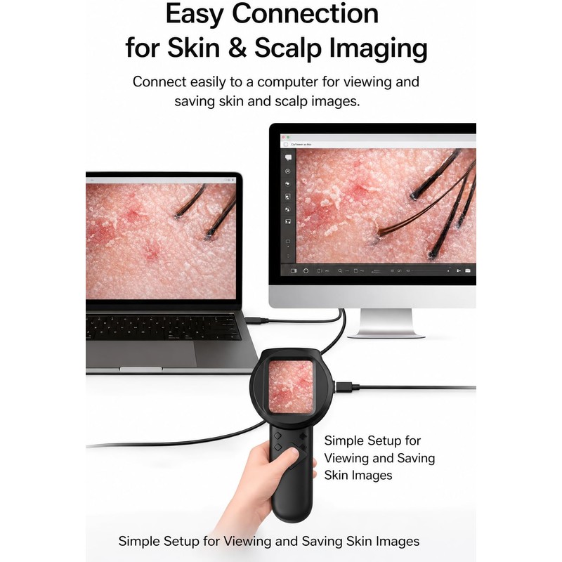 Digital Dermascope for Skin, Up to 500X Viewing, 2.8” IPS