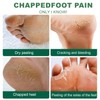 Tea Tree Oil Foot Cream,Tea Tree Foot Cream,Nourishing & Hydrating