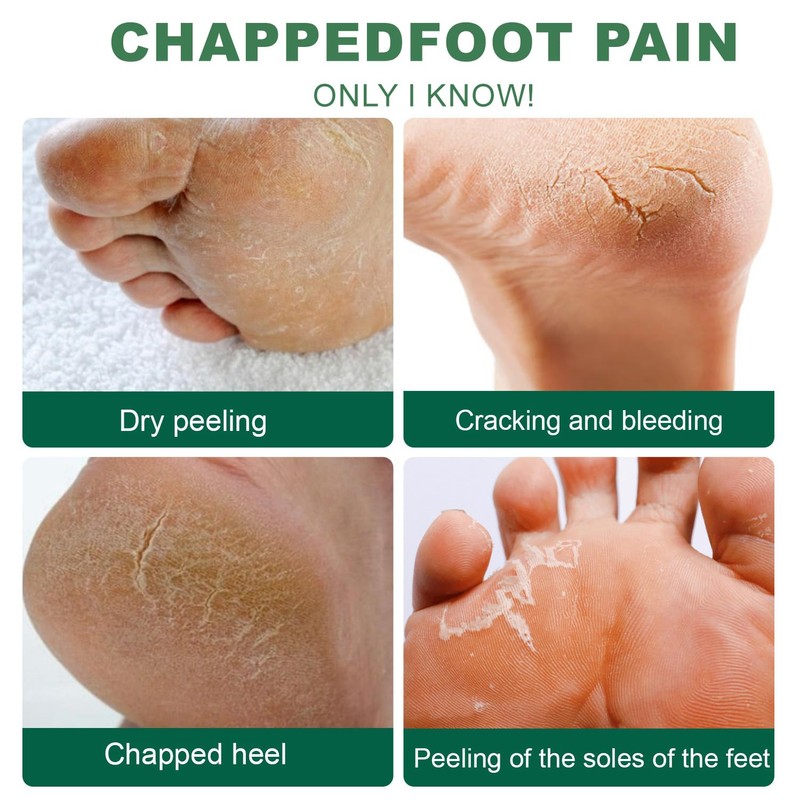Tea Tree Oil Foot Cream,Tea Tree Foot Cream,Nourishing & Hydrating