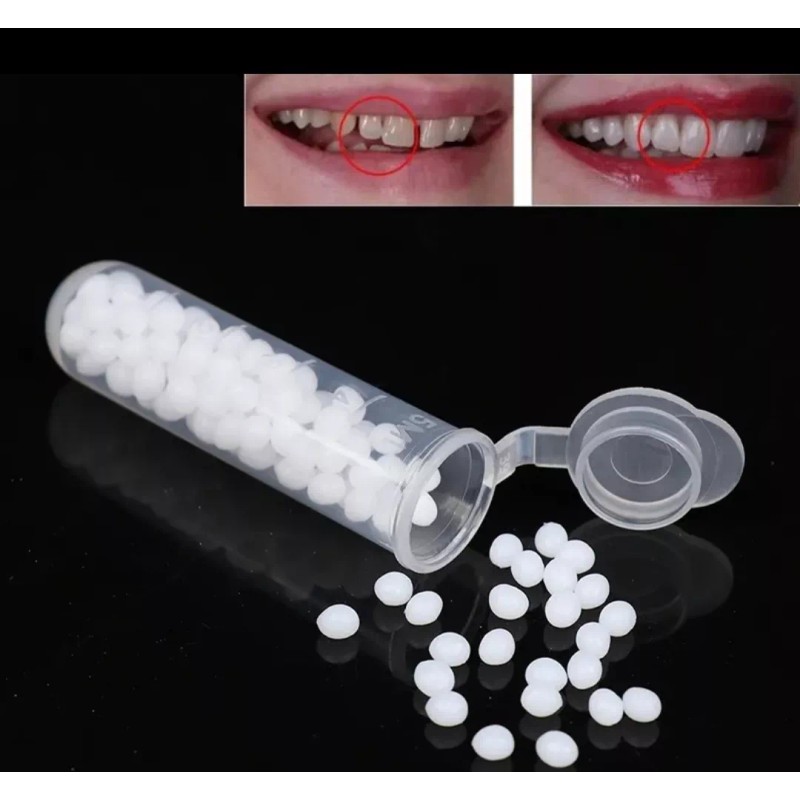 Reparación De Dientes, Sólido,temporal Duradero,reutilizable