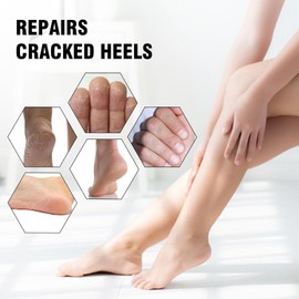 Set De Calcetines Y Guantes Hidratantes, Calcetines De Gel De Silicona Para Talones Agrietados Y Pies Secos Para Mujer, Guantes Hidratantes De Spa Para El Cuidado De Las Manos, Alivio Y Trata