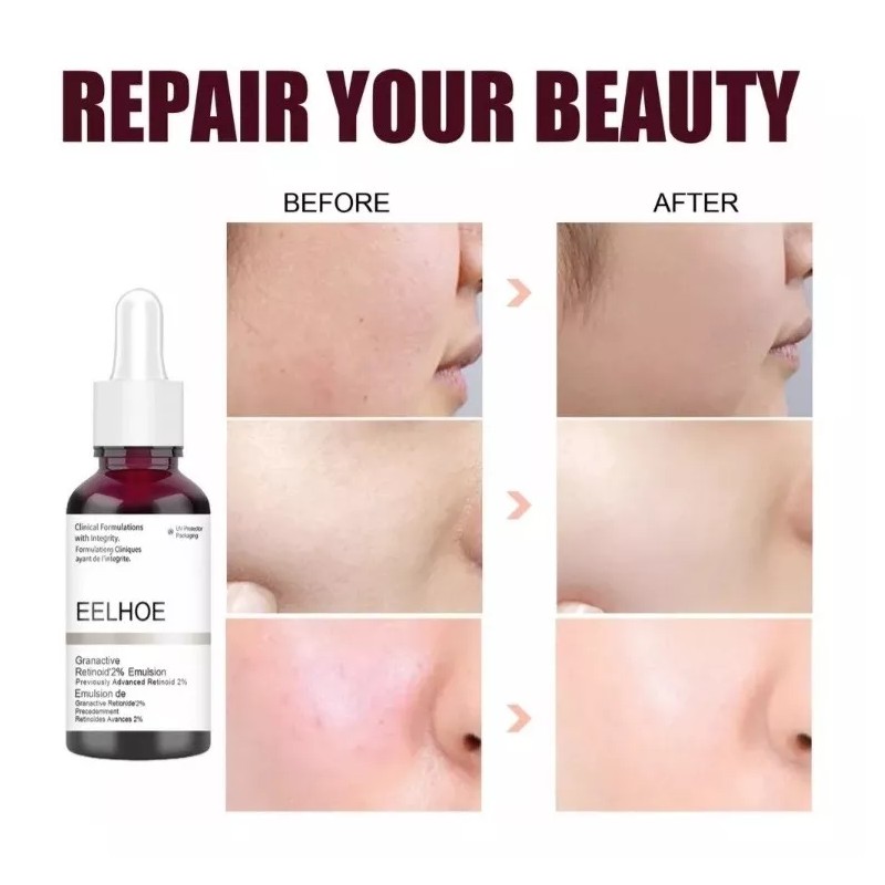 Eelhoe Granactive Retinoid 2% Emulsión 30ml
