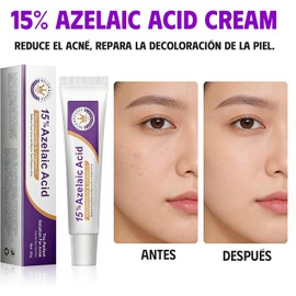 Ácido Azelaico Suero Facial al 15%, Crema Hidratante Facial, 20g*1 Reduce Rojeces e Imperfecciones, Rejuvenece la Piel