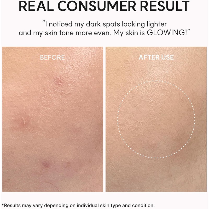 Arencia Txa Booster Shot Serum with 5% Tranexamic Acid &