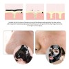 Mascarilla Puntos Negros Carbon Activo Espinillas Bioaqua Tipo de piel