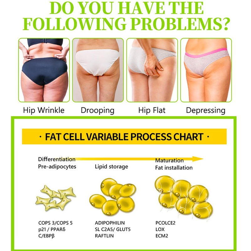 AICHUN BEAUTY Thin HIPS Cream Eliminates Excess Fat Reduces Hip
