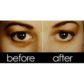 Irene Gari Eye Concealers Dark Circle Concealer