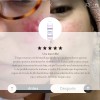 Controla El Acne Matifica Desinflama Rosacea Locion Azelaico Momento de