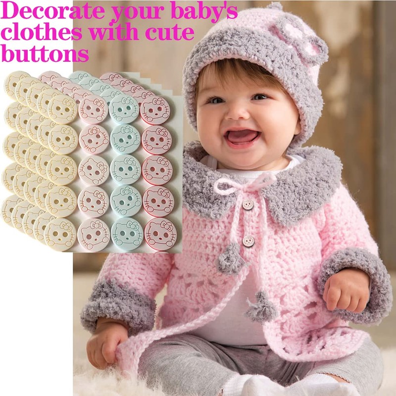 (100pcs) buttons for baby cardigans baby buttons baby buttons for