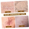 Outanaya Scar Concealing Tape for Birthmarks Flaws Skin Tone Lightweight