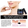 Eelhoe Crema Antiedad Para Rostro Cuello y Pecho Elimina Manchas