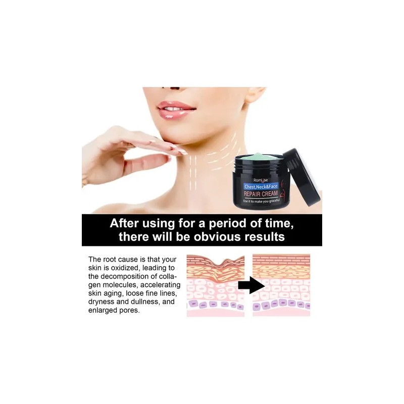 Eelhoe Crema Antiedad Para Rostro Cuello y Pecho Elimina Manchas