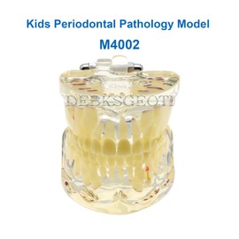 Dental Kids Typodont Pediatric Model Teeth with Caries, Cyst, and Firstula, It Demonstrates The Developing Dentition of Age 6-9 Children (M4002)