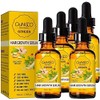 Tratamiento de pérdida de cabello Esencia de crecimiento del cabello