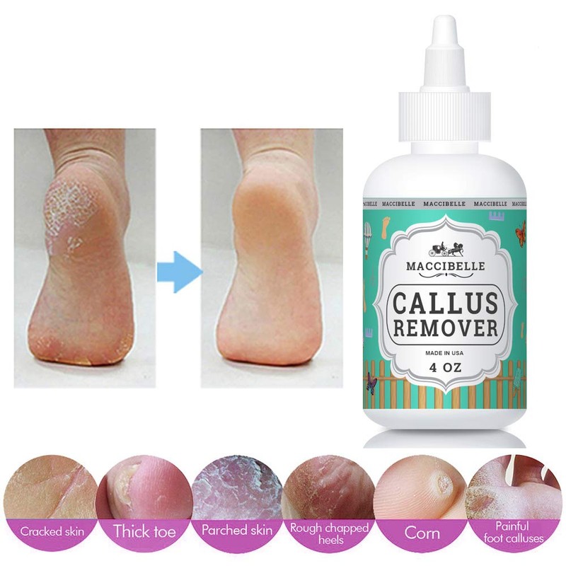 Maccibelle Callus Remover EXTRA STRENGTH For Feet, Professional Callus and