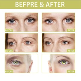 Retinol Tightening Booster,Retinol Serum For Face,Reti-Nol Eye Cream,Reti-Nol Face Cream,Lifting Ret-Inol Mild Facial Skincare Firming Serums,Anti Wrinkles&Fine Lines For All Skin Types,Moisturizing