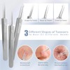 FEITA - Kit de herramientas para quitar espinillas, extractor de