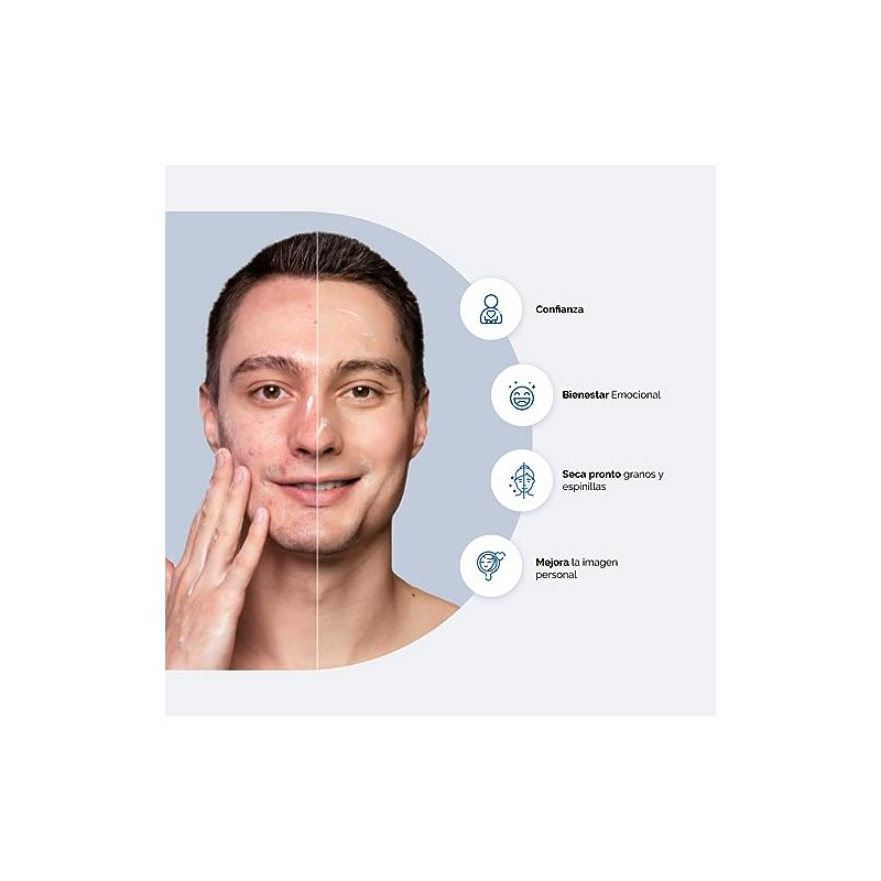 BPOllen Gel Peróxido de Benzoilo 5% 30 g