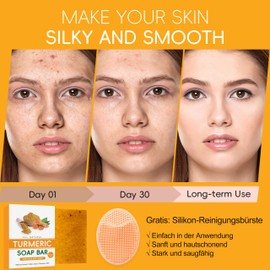 Turmeric Kojic Acid Soap - Turmeric Soap Piece Lemon Turmeric Soap for Face and Body, Turmeric Brightening Soap Deep Cleansing for Against Impurities, Ginger Soap Gentle Cleansing Skin (2 Pieces)