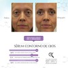 Marie dArgan Srum Contorno de Ojos - Hinchazn y Ojeras