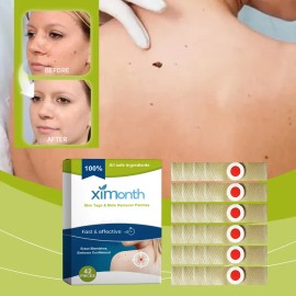 Parche Para Verrugas Ximonth, Reparador De Verrugas, Zh Za