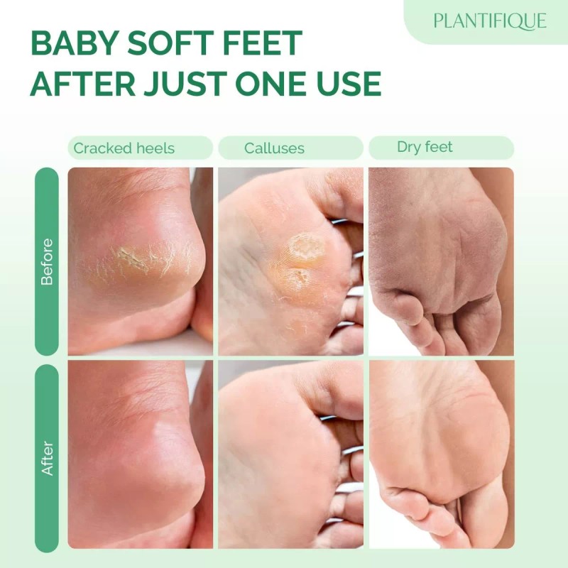 Plantifique, Mascarilla Exfoliante Para Pies - Fresa