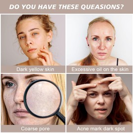 LOPHE Niacinamide Facial Moisturizing Serum, Retinol Anti Aging Serum, 10% Niacinamide & 1% Zinc Serum, Niacinamide Anti Wrinkle Essence for Reduce Wrinkle, Plump & Smooth Skin, Evens Skin Tone, 2PCS