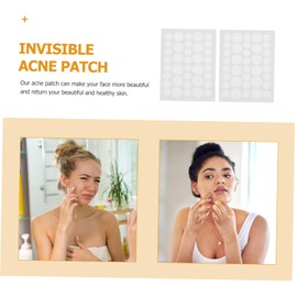 Healeved 216pcs Hydrocolloid Patches Invisible Hydrocolloid Stickers for Pimple Removal Face Care and Smooth Skin Treatment Daily Use Pimple Healing