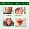 Aceite Esencial De Romero Crecimiento Cabello Cuidado Piel