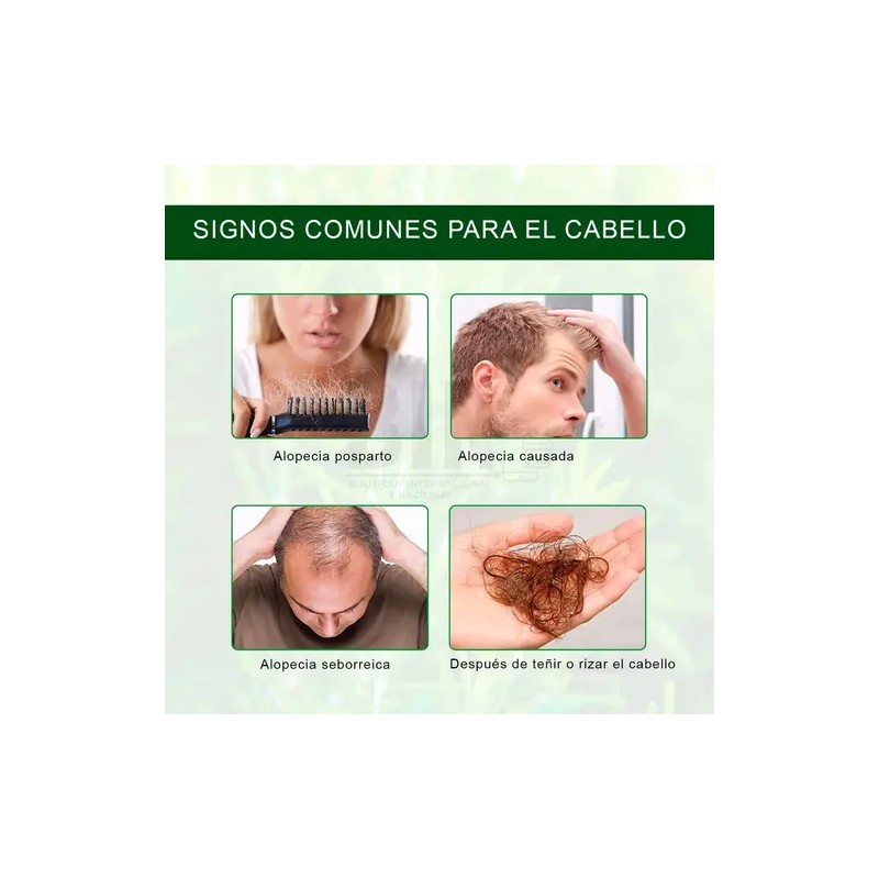 Aceite Esencial De Romero Crecimiento Cabello Cuidado Piel