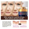 Para Fd Crema Facial Qingling Arrugas Qingling, 1 Ud