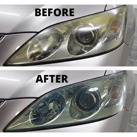 SONAX Profiline Headlight Restoration Kit | Complete DIY Headlight Repair & Protection | Removes Yellowing, Foggy Haze & Oxidation | Includes Polish, Protection, P-Ball, Pads & Microfiber | 405741