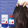 Champú Antidandico, Pérdida De Cabello, Control De Aceite
