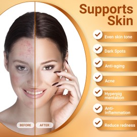 Twins Personal Care Egg Soap, Luxurious Handmade Egg Shaped with Kojic & Hyaluronic Acid Soap, Natural ingredients