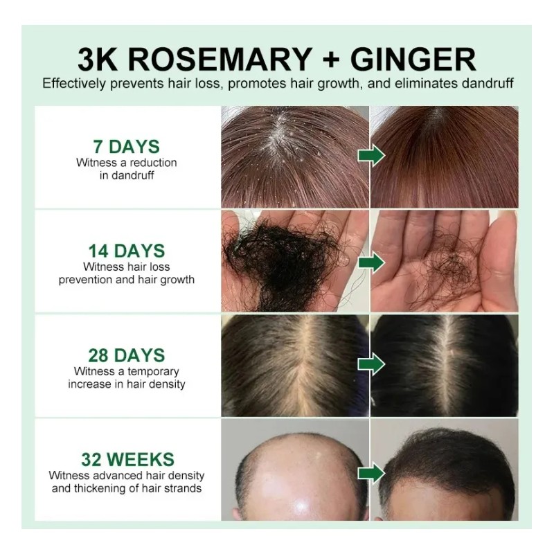 Aceite Capilar Romero Anticaída Crecimiento Control Caída 50