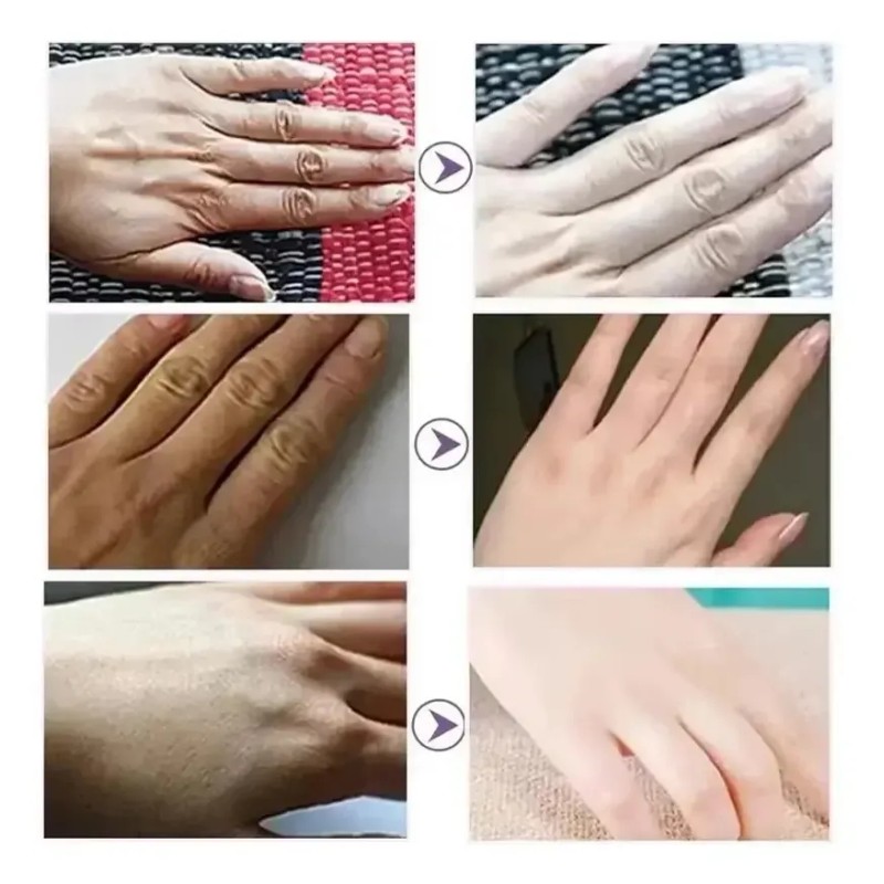 Crema Eliminadora De Arrugas Que No Seca A Mano, Cuidado
