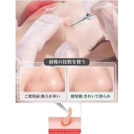 Mirhua Square Plug Tweezers, Precision Tweezers (Set of 3), Tip Width 0.004 inches (0.1 mm), Universal Type, Square Stoppers, Hair Tweezers, Ultra Fine, Supervised by Skin Beauty Specialist, Acne