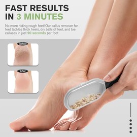 FERYES FERYES Foot File Callus Remover with Dead Skin Catcher C The Genius Foot Scrubber for Mess-Free Pedicures, Heel Scraper for Cracked Heel Treatment, Wet & Dry Use Feet Rasp - Black