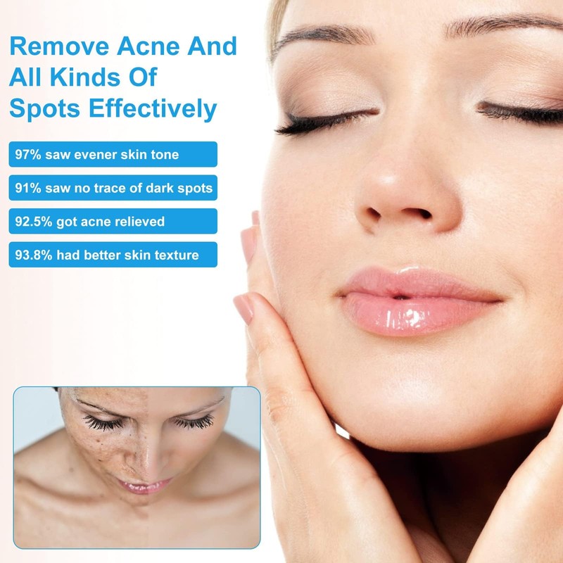Crema para Manchas Oscuras en La Cara, Cremas para Quitar