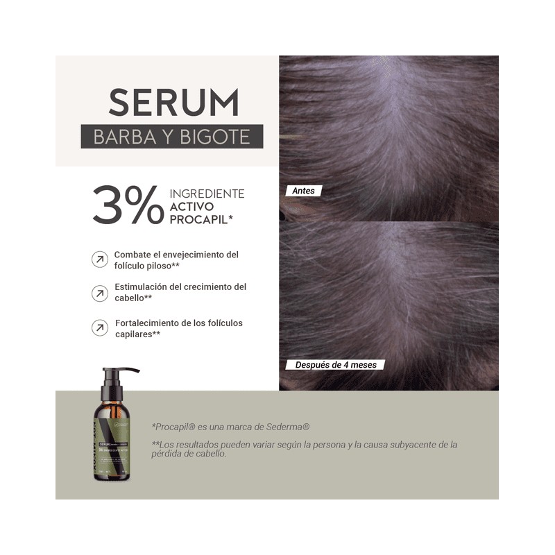 Crecimiento Barba y Bigote 3% Ingrediente Activo 90 ml Not-Minox