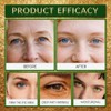 120PCS Avocado Eye Patches, Reduce Fine Lines and Wrinkles, Moisturizing