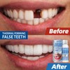 Resin Tooth Repair Glue Shapeable Teeth Gaps Filling Solid Temporary