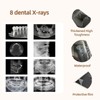 8 Dental X-Rays