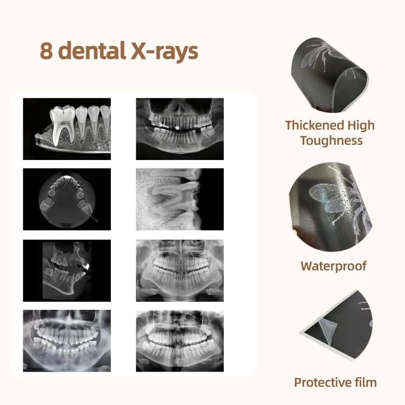 8 Dental X-Rays