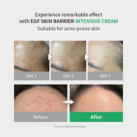 zipiderm [zipiderm]EGF Skin Barrier Intensive Cream 80ml